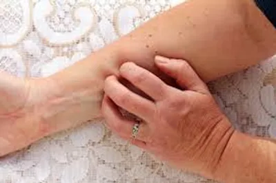 Illustration revulsion - Image 2