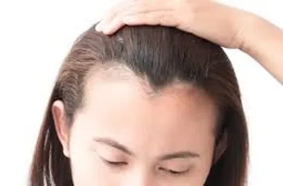 Illustration hairline - Image 2