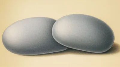 Illustration couple - Image 1