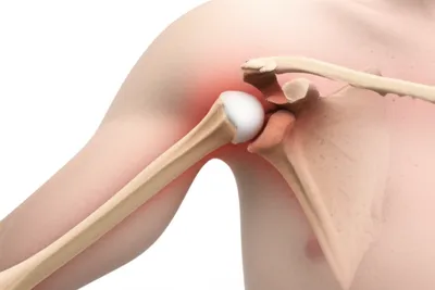 Illustration lux - Image 1