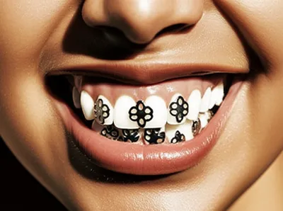 Illustration grills - Image 1