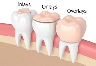 Illustration inlay - Image 2