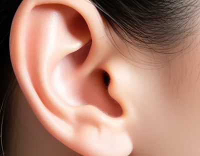 Illustration earhole - Image 1