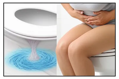 Illustration bogging - Image 1