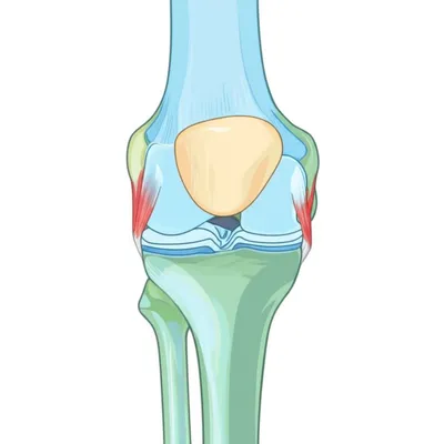 Illustration jointing - Image 1