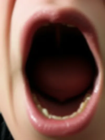 Illustration yawning - Image 2