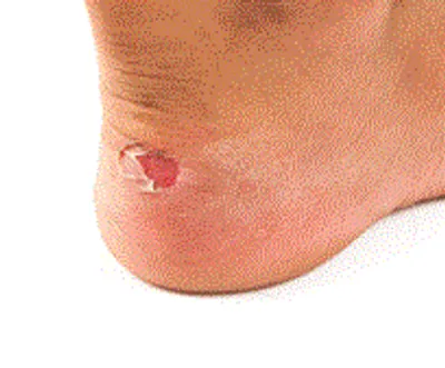 Illustration gall - Image 2