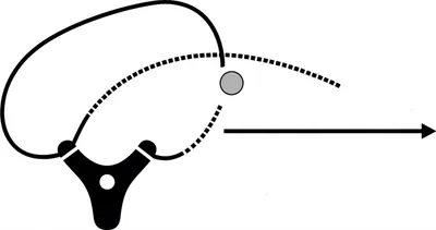 Illustration sling - Image 1