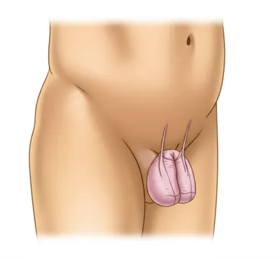 Illustration scrotum