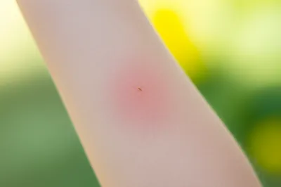 Illustration stings - Image 1