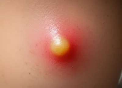 Illustration pushes - Image 1