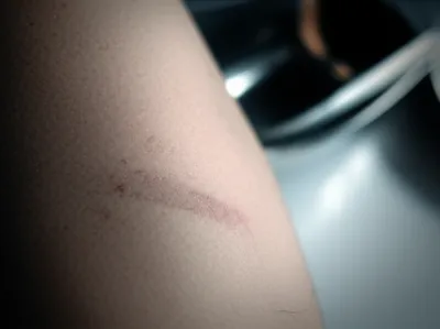 Illustration banged - Image 1