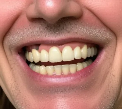 Illustration abutments - Image 1