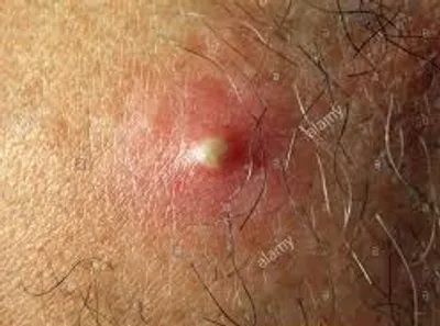 Illustration matter - Image 3