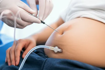 Illustration tapping - Image 1