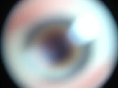 Illustration clouding - Image 1