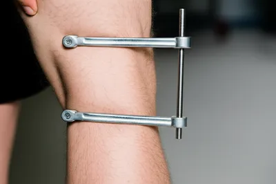 Illustration cramps - Image 1