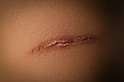 Illustration seams - Image 1