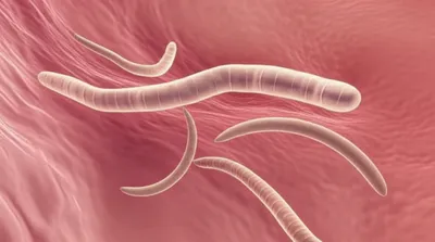 Illustration roundworms - Image 1