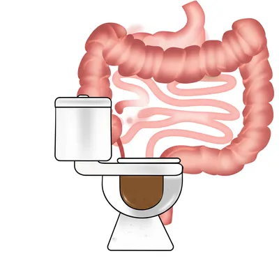 Illustration evacuation - Image 1