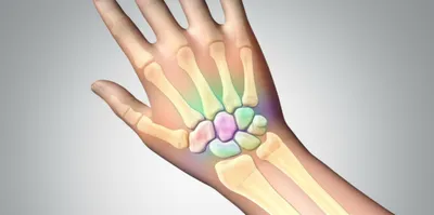 Illustration carpal