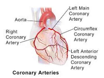 Illustration coronary - Image 2
