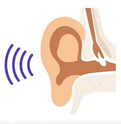 Illustration hearing