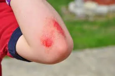 Illustration scrape - Image 3