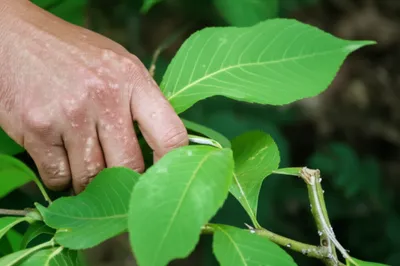 Illustration vesicant