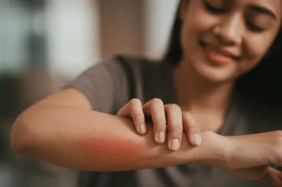 Illustration itched - Image 1