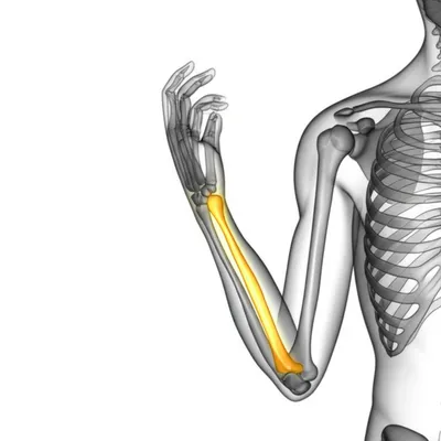 Hình ảnh minh họa radius - Ảnh 1