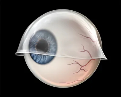 Illustration eyelid
