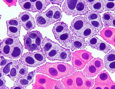 Illustration counterstained - Image 1