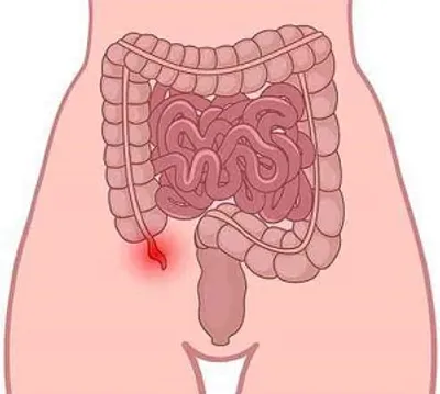 Illustration vestige - Image 2