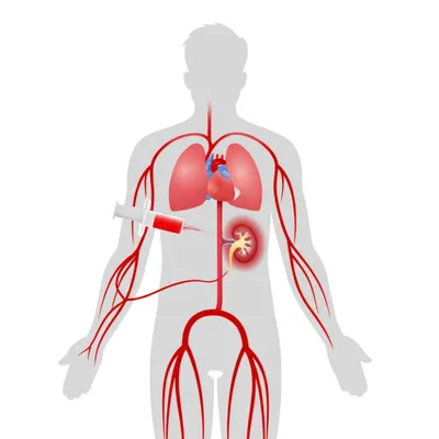 Illustration perfusions - Image 1