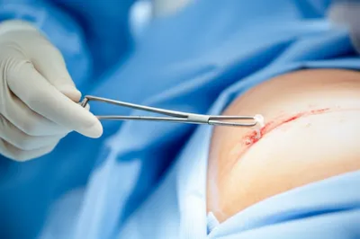 Illustration retriever - Image 1