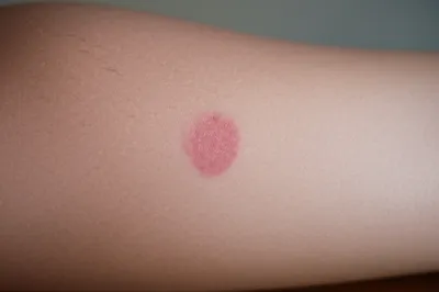 Illustration strawberry - Image 1