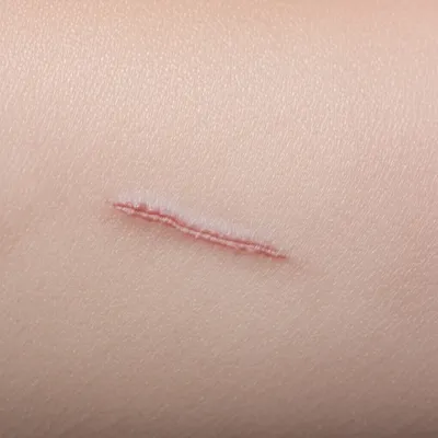 Illustration scars - Image 1