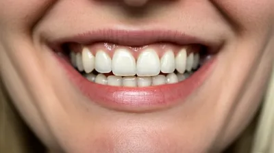 Illustration grille - Image 1