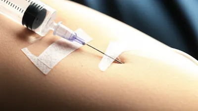 Illustration banging - Image 1