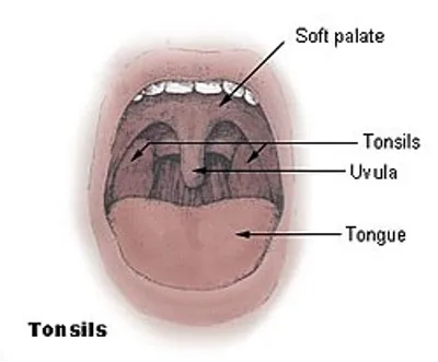 Illustration tonsil - Image 2