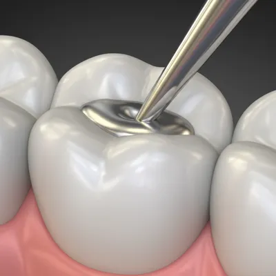 Illustration amalgam - Image 1