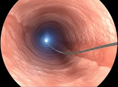 Illustration scope - Image 1