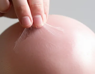 Illustration scalp - Image 1