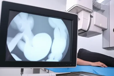 Illustration barium - Image 1