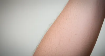 Illustration creeping - Image 1