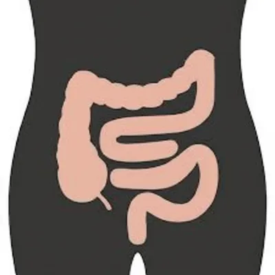 Illustration sigmoid - Image 1