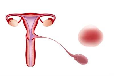 Illustration sexually - Image 1