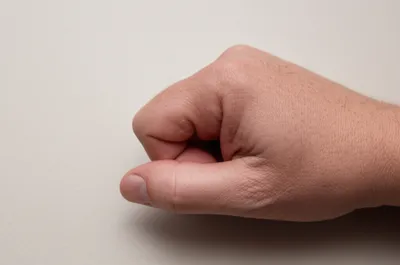 Illustration swollen - Image 1