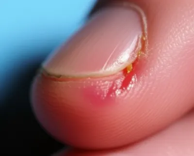 Illustration felons - Image 1